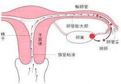 输卵管炎症状,识别与应对策略”